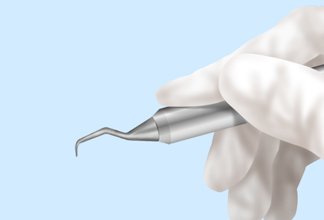 STEP04 ハンドスケーラーによる歯石除去
